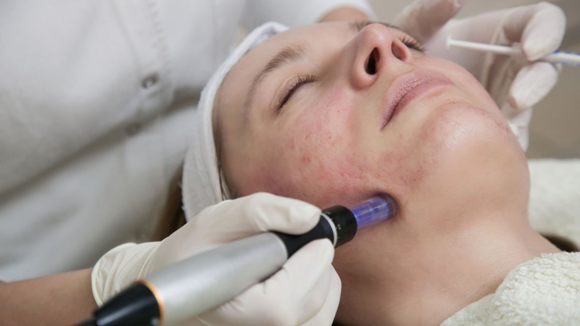 Cosmetic professional performs facial treatment with medical device